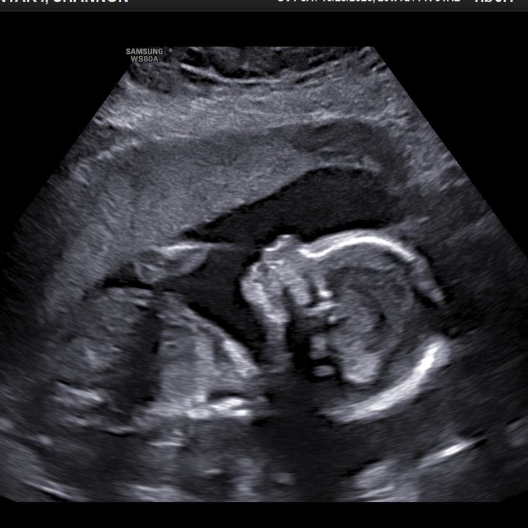 Photo shared by Shannon for their Babylist baby registry.