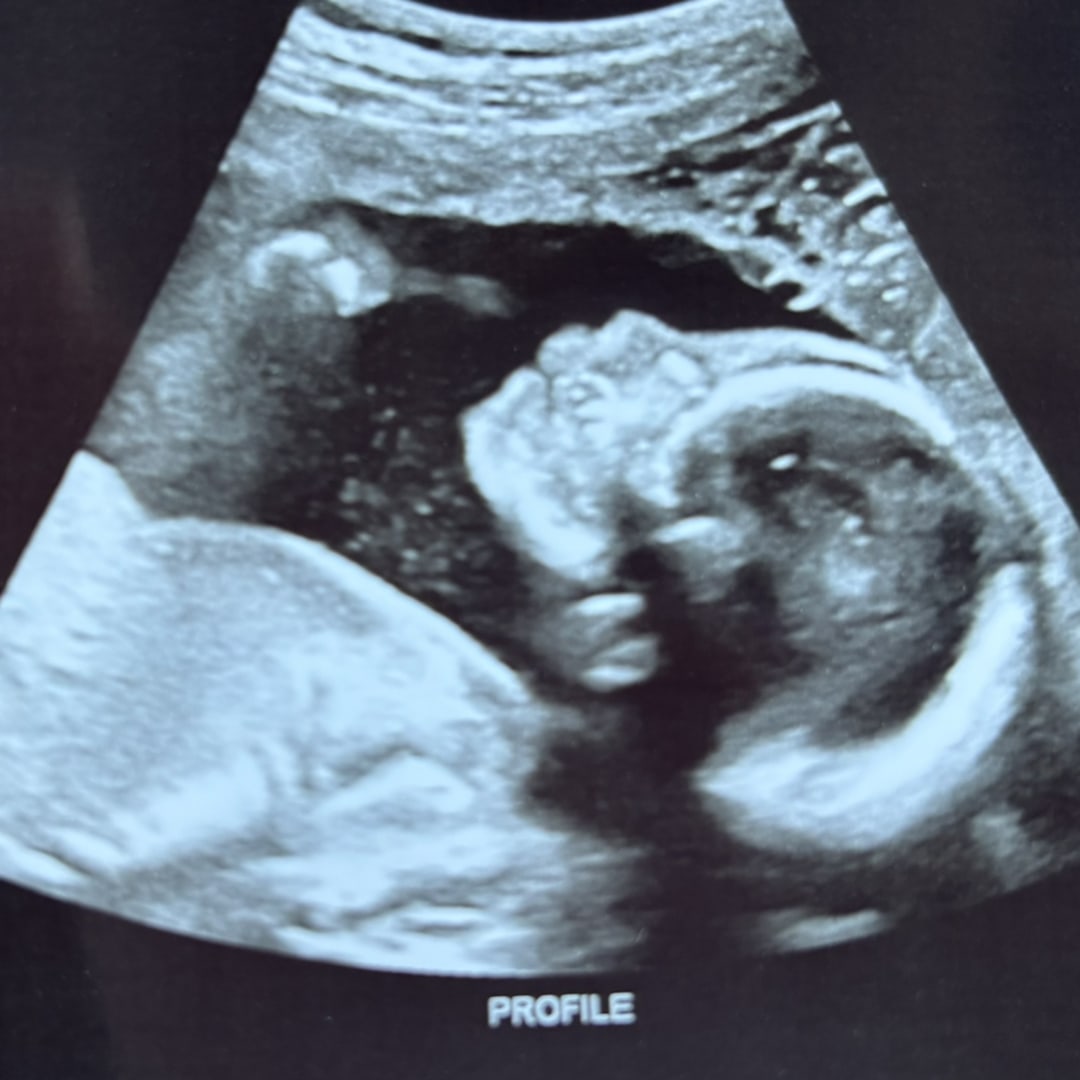 Photo shared by Amayia for their Babylist baby registry.