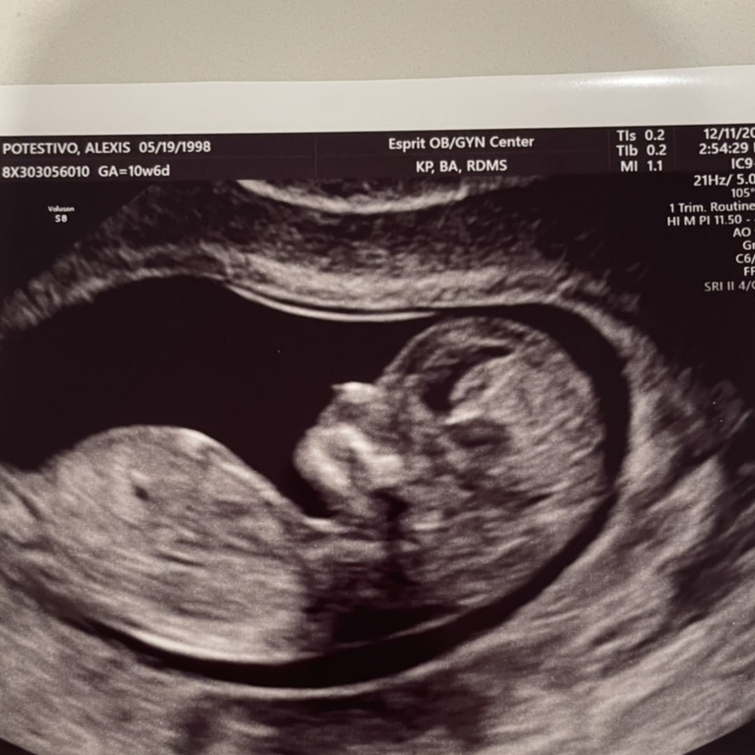 Photo shared by Alexis for their Babylist baby registry.