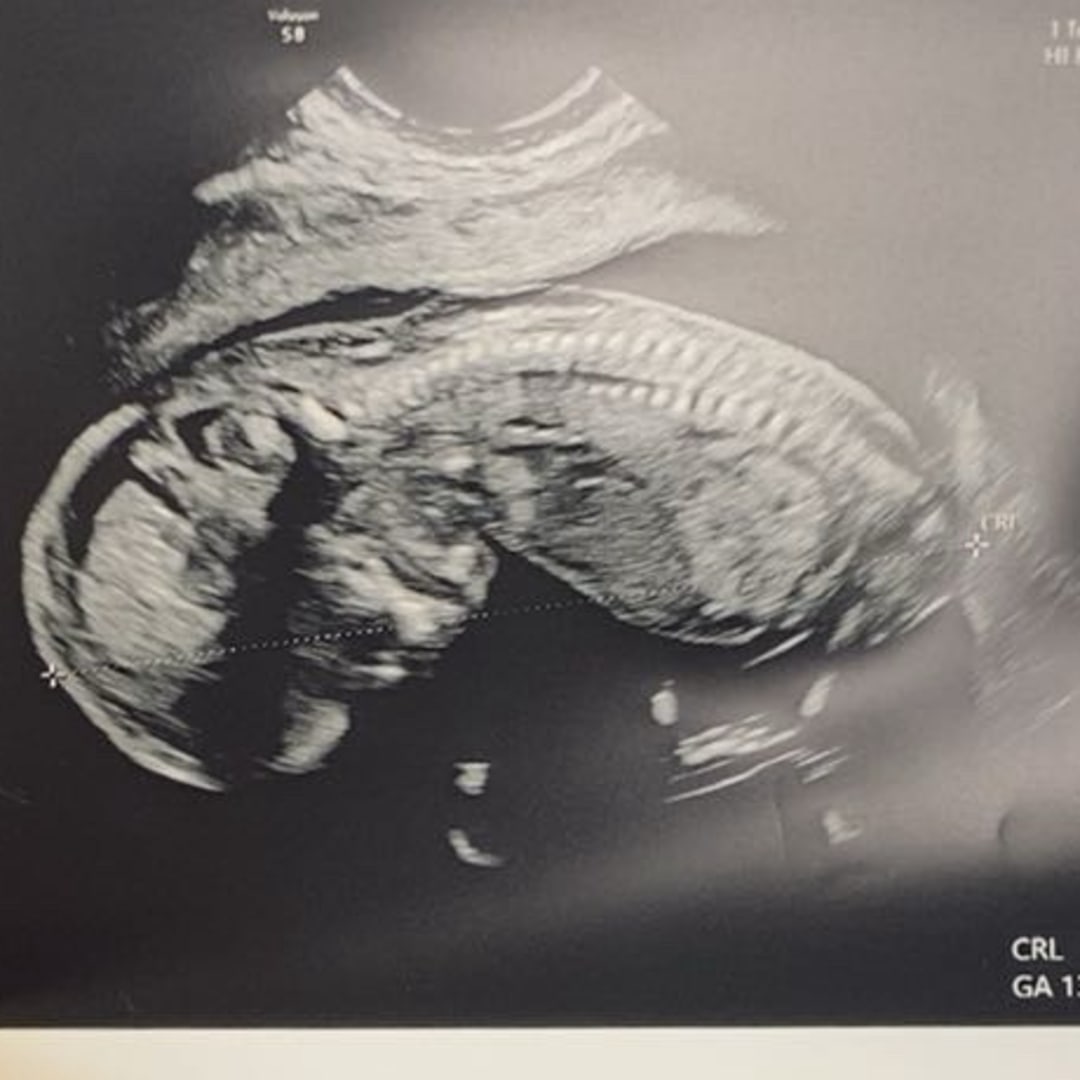 Photo shared by Deleighla for their Babylist baby registry.