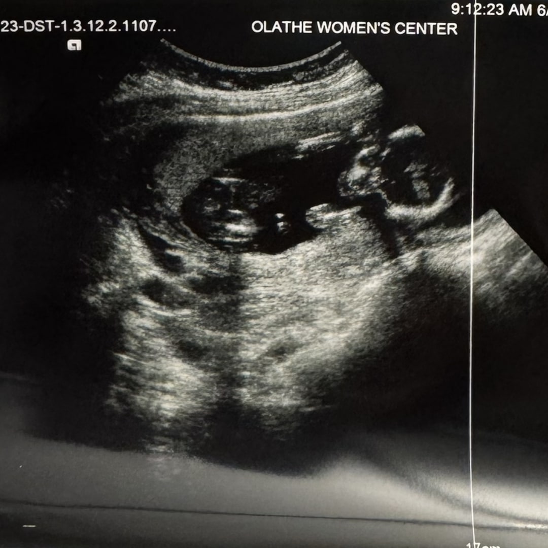 Photo shared by Emleigh for their Babylist baby registry.