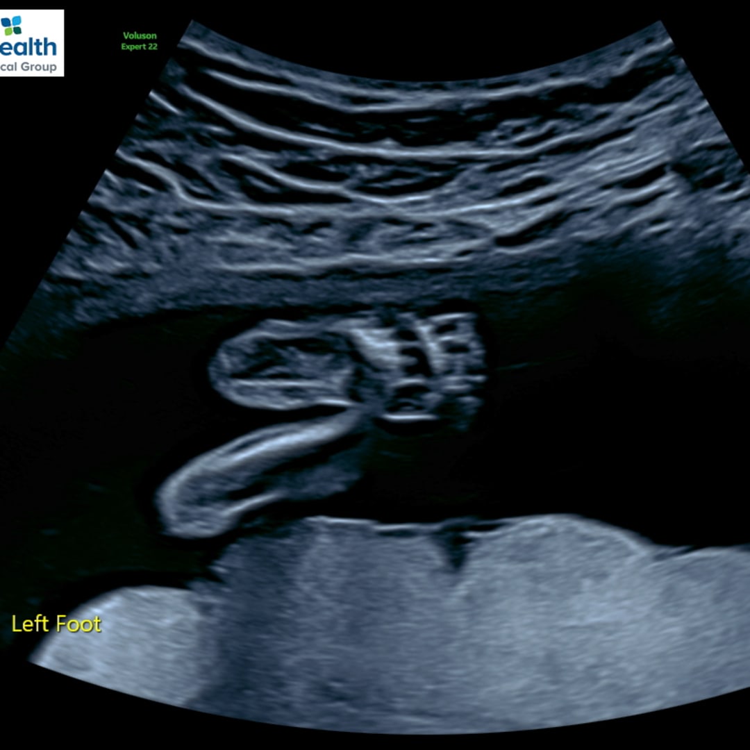 Photo shared by Caroline for their Babylist baby registry.