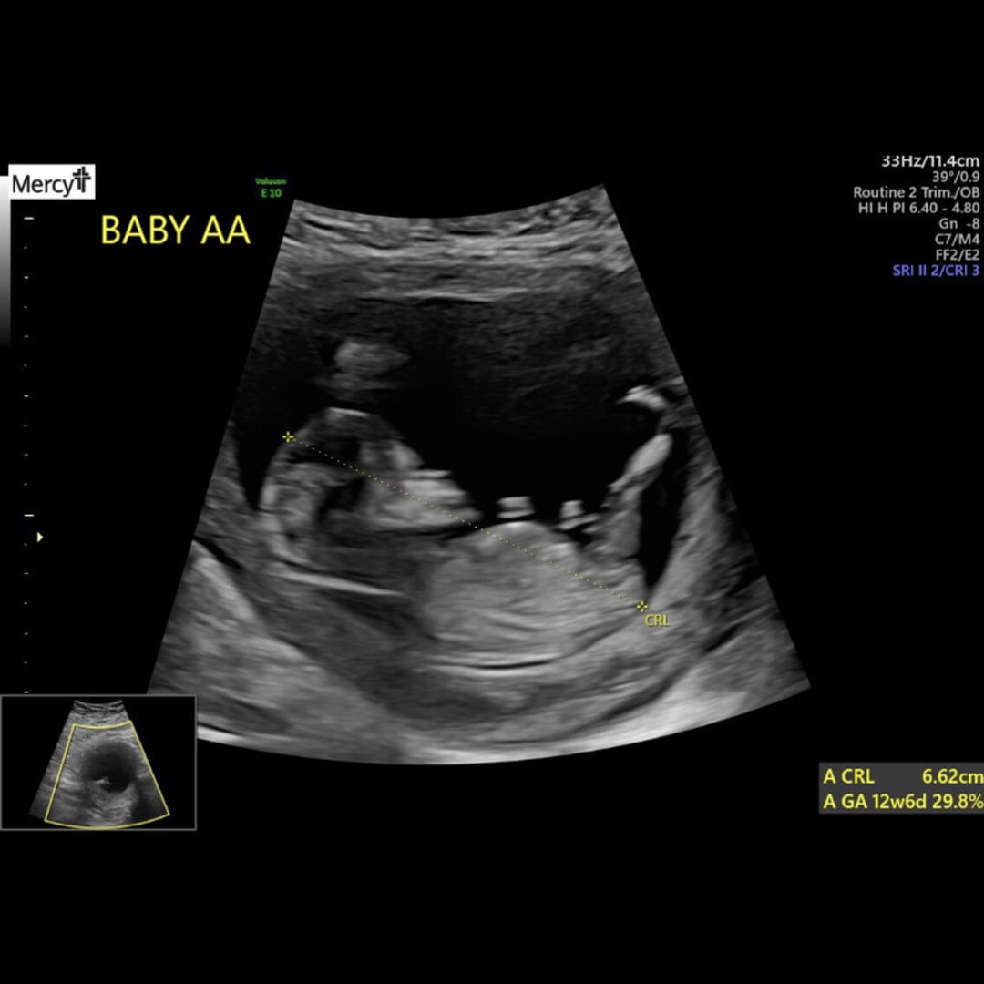 Photo shared by Madison for their Babylist baby registry.