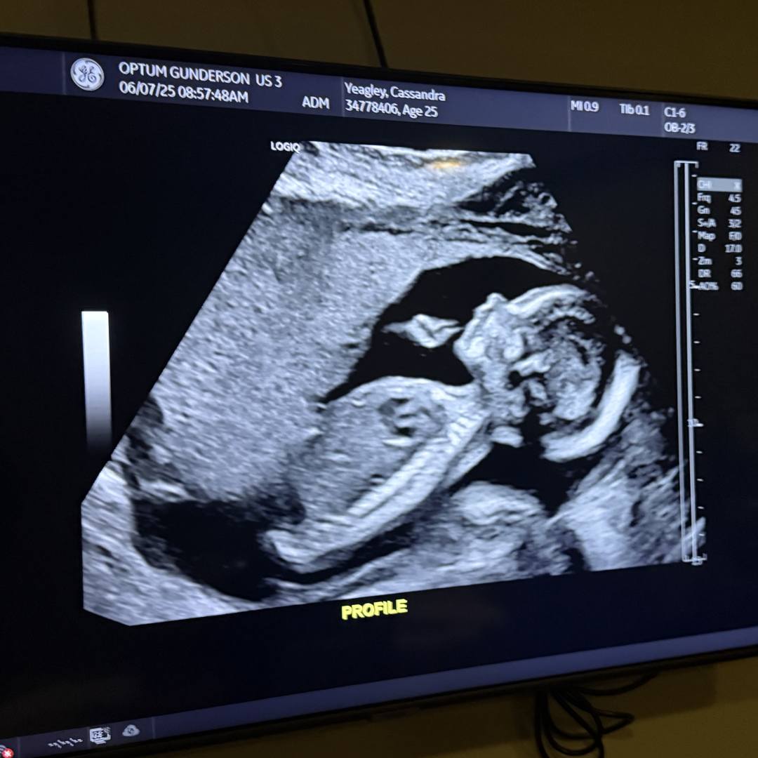 Photo shared by Cassandra for their Babylist baby registry.