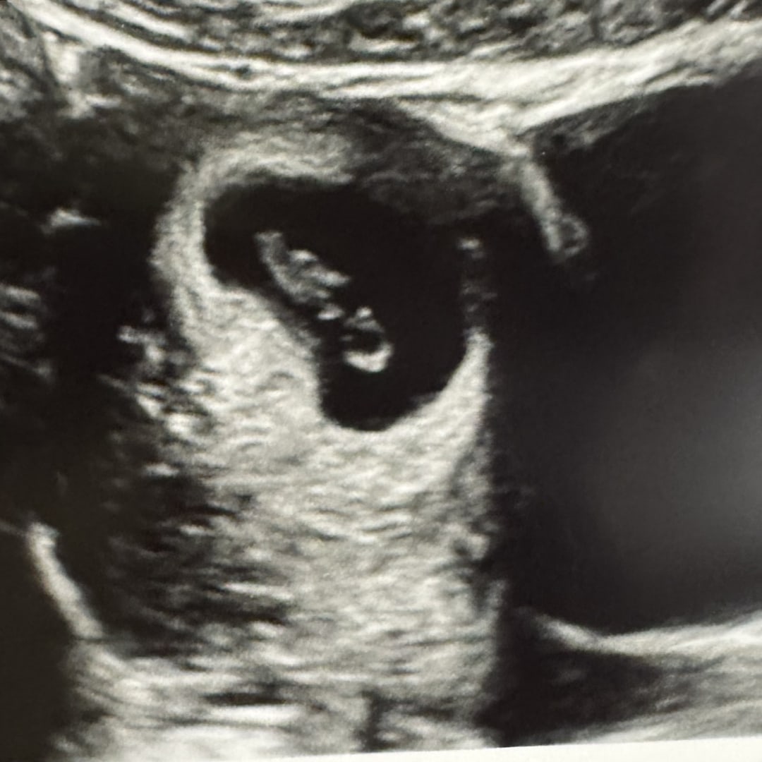 Photo shared by Jordyn for their Babylist baby registry.