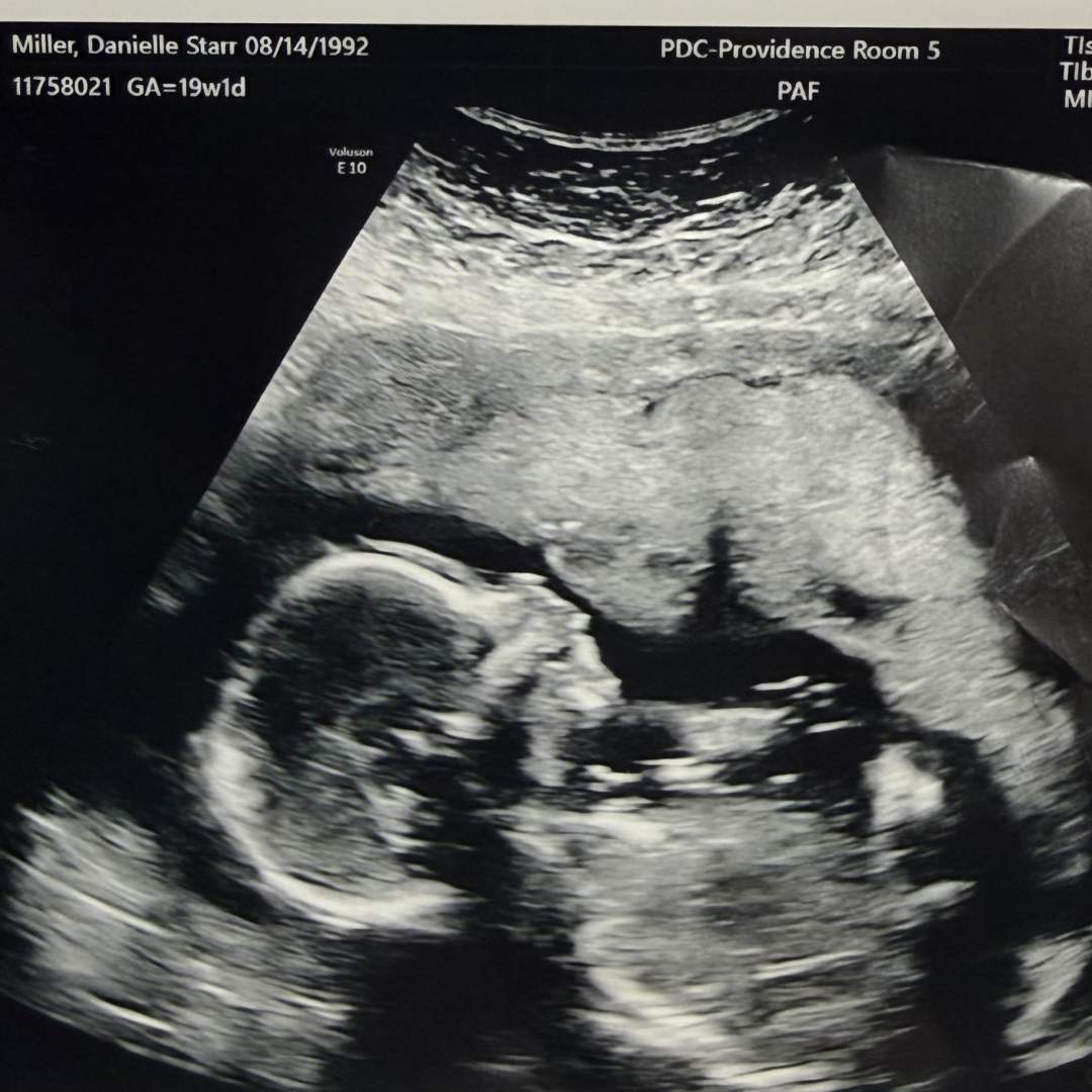 Photo shared by Danie for their Babylist baby registry.