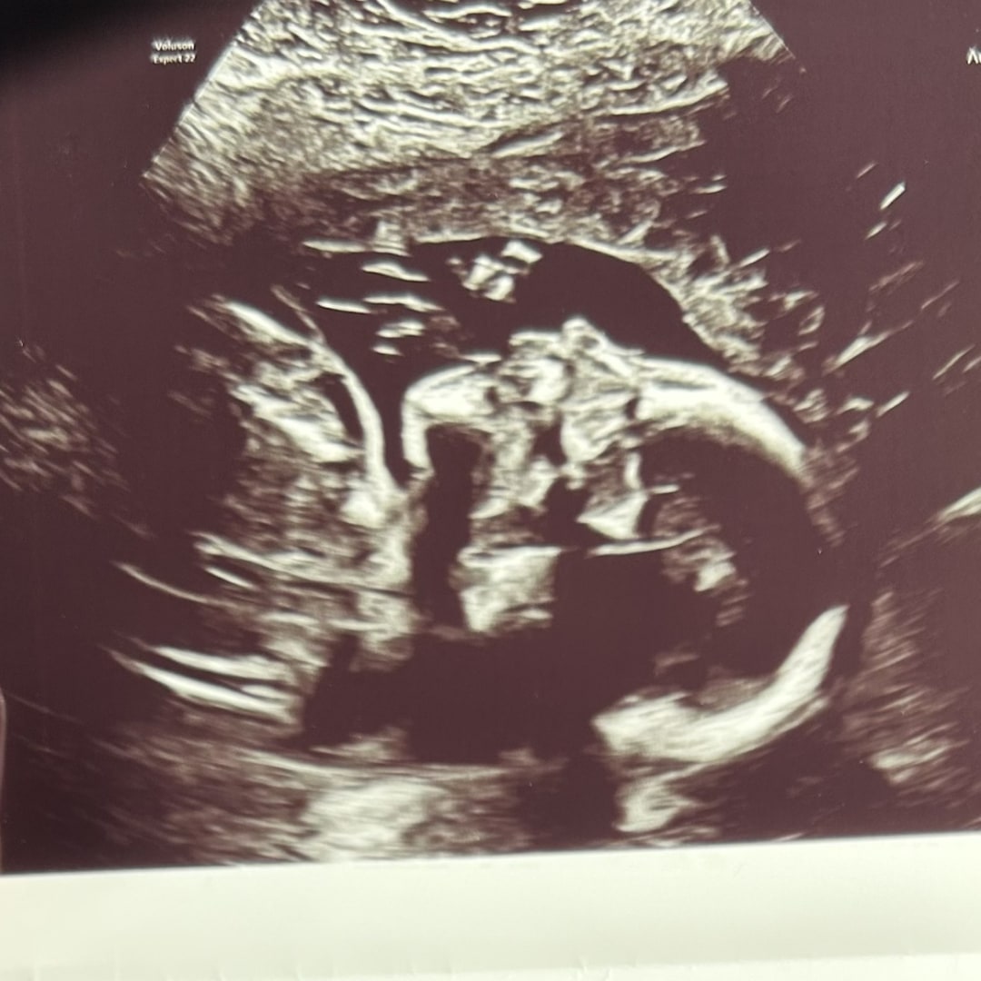 Photo shared by Eris for their Babylist baby registry.