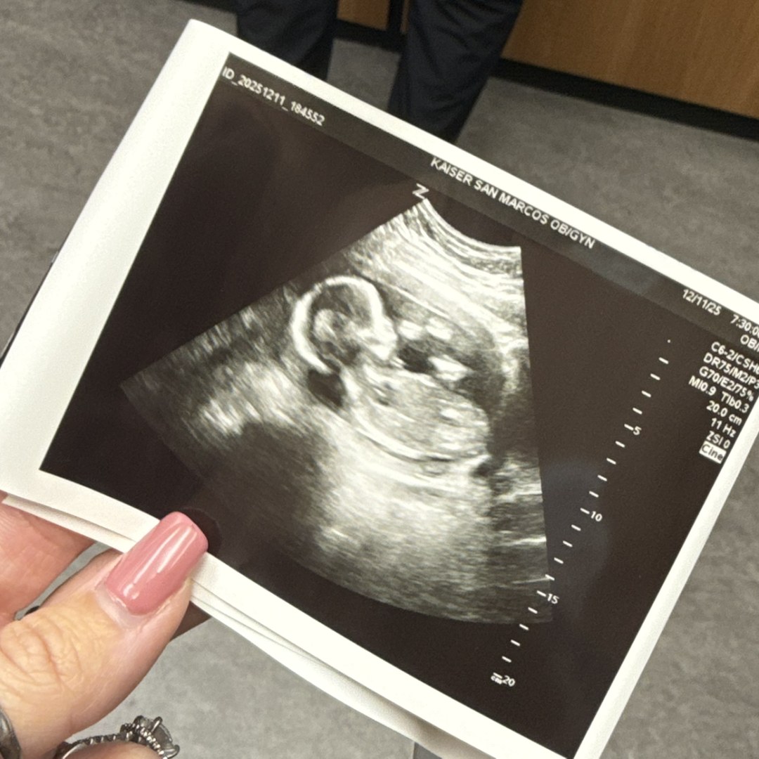 Photo shared by Madison for their Babylist baby registry.