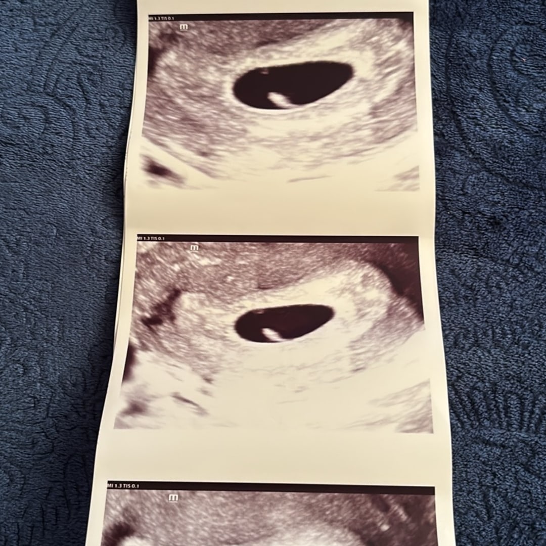 Photo shared by Jaeda for their Babylist baby registry.