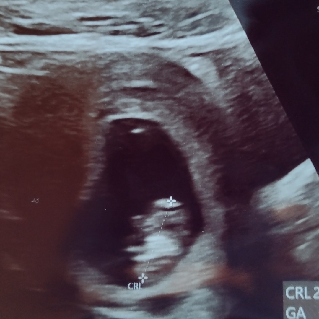 Photo shared by Anna for their Babylist baby registry.