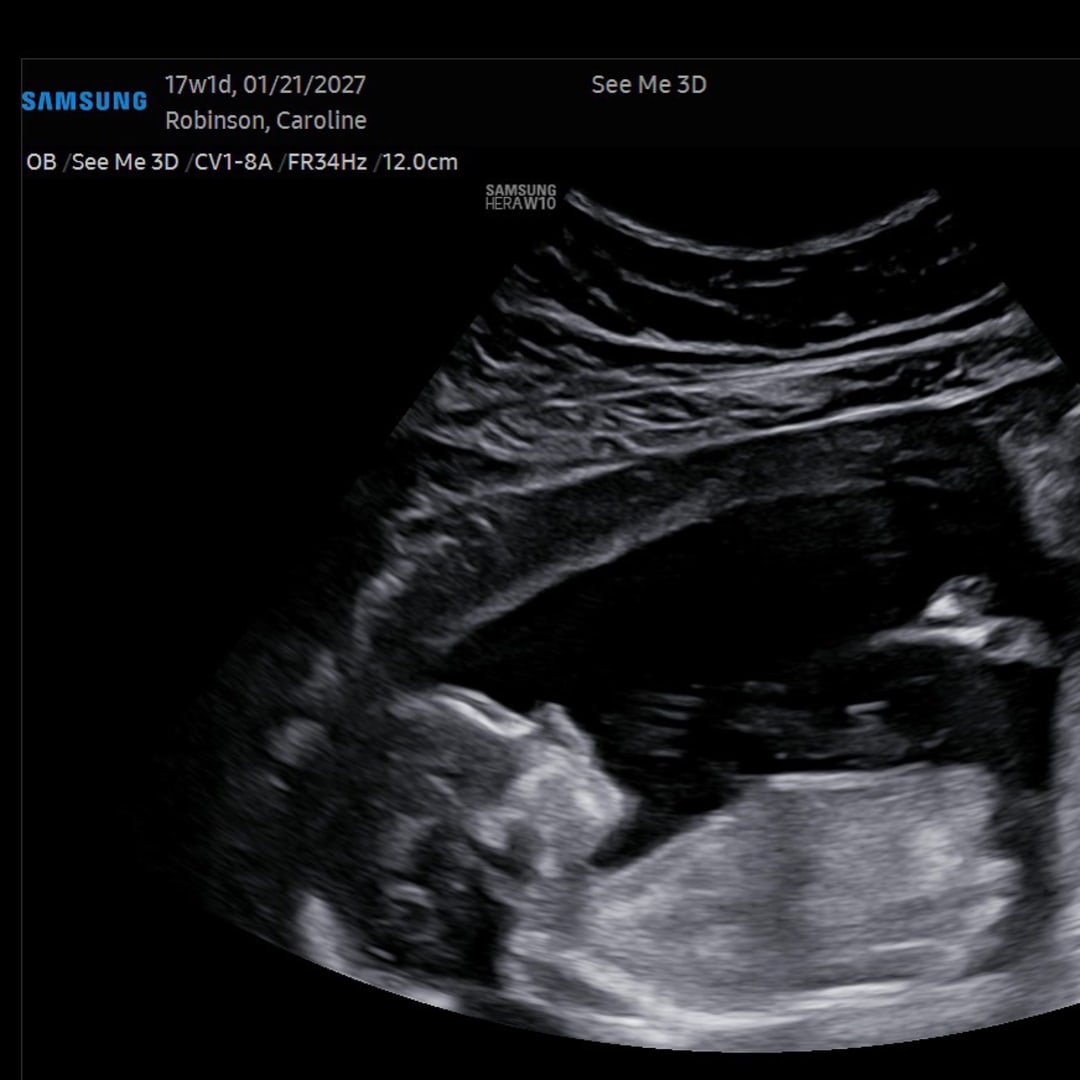 Photo shared by Caroline for their Babylist baby registry.