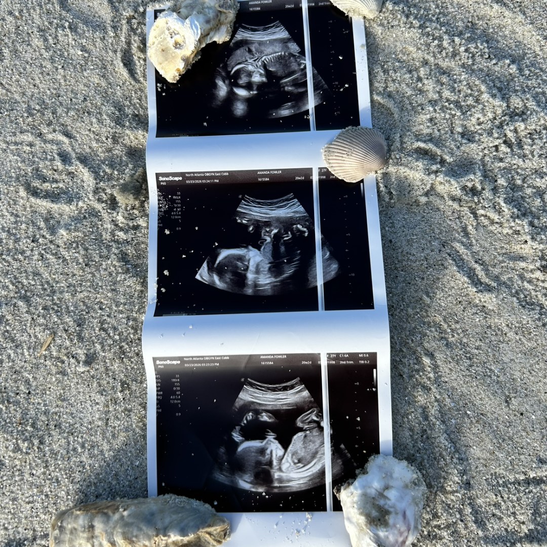 Photo shared by Amanda for their Babylist baby registry.