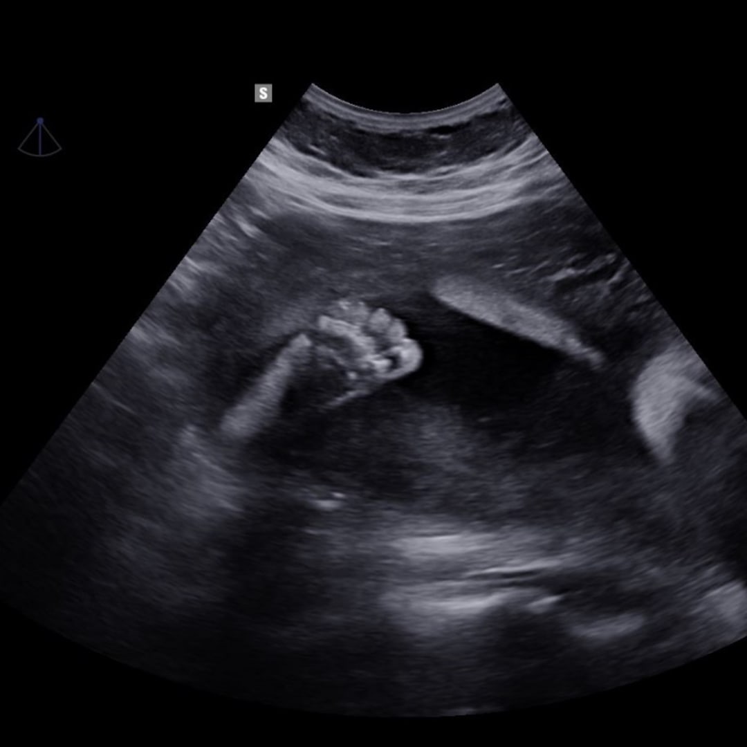 Photo shared by Danielle for their Babylist baby registry.