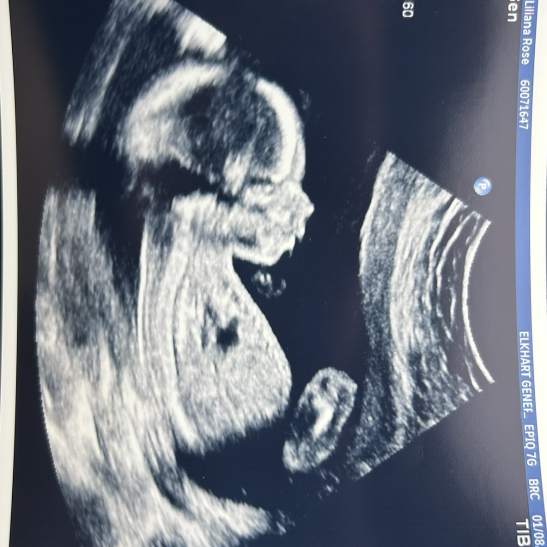 Photo shared by Liliana for their Babylist baby registry.