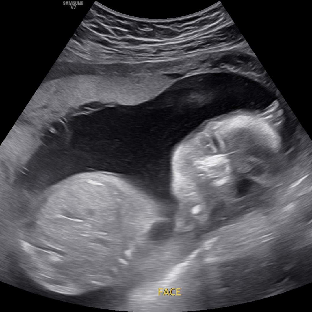 Photo shared by Catherine for their Babylist baby registry.
