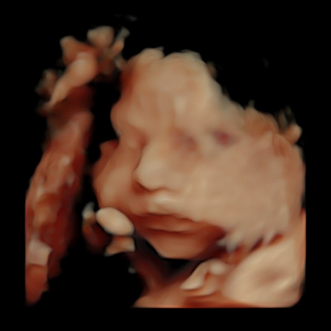 Photo shared by Melissa for their Babylist baby registry.