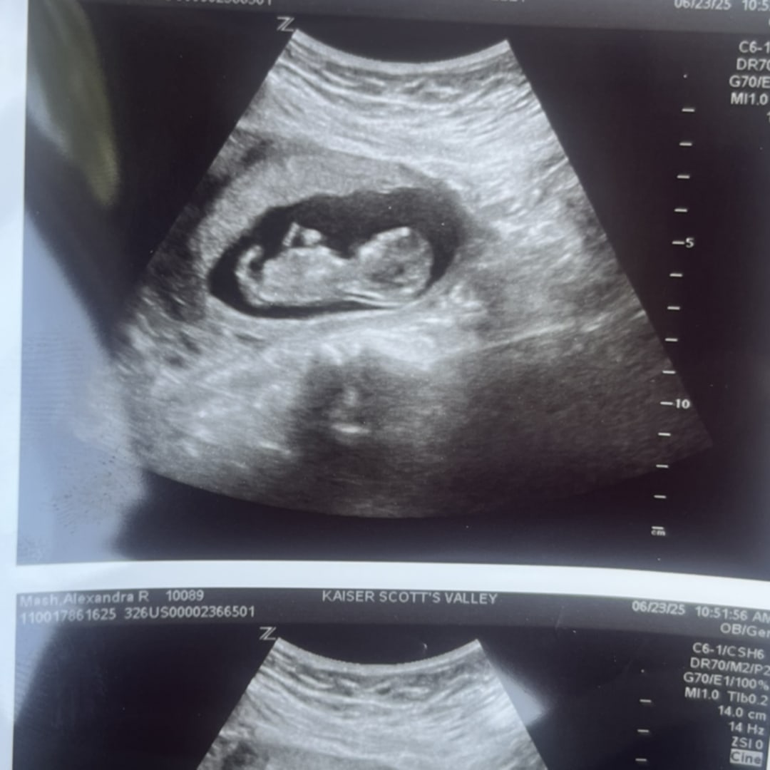 Photo shared by Alex for their Babylist baby registry.