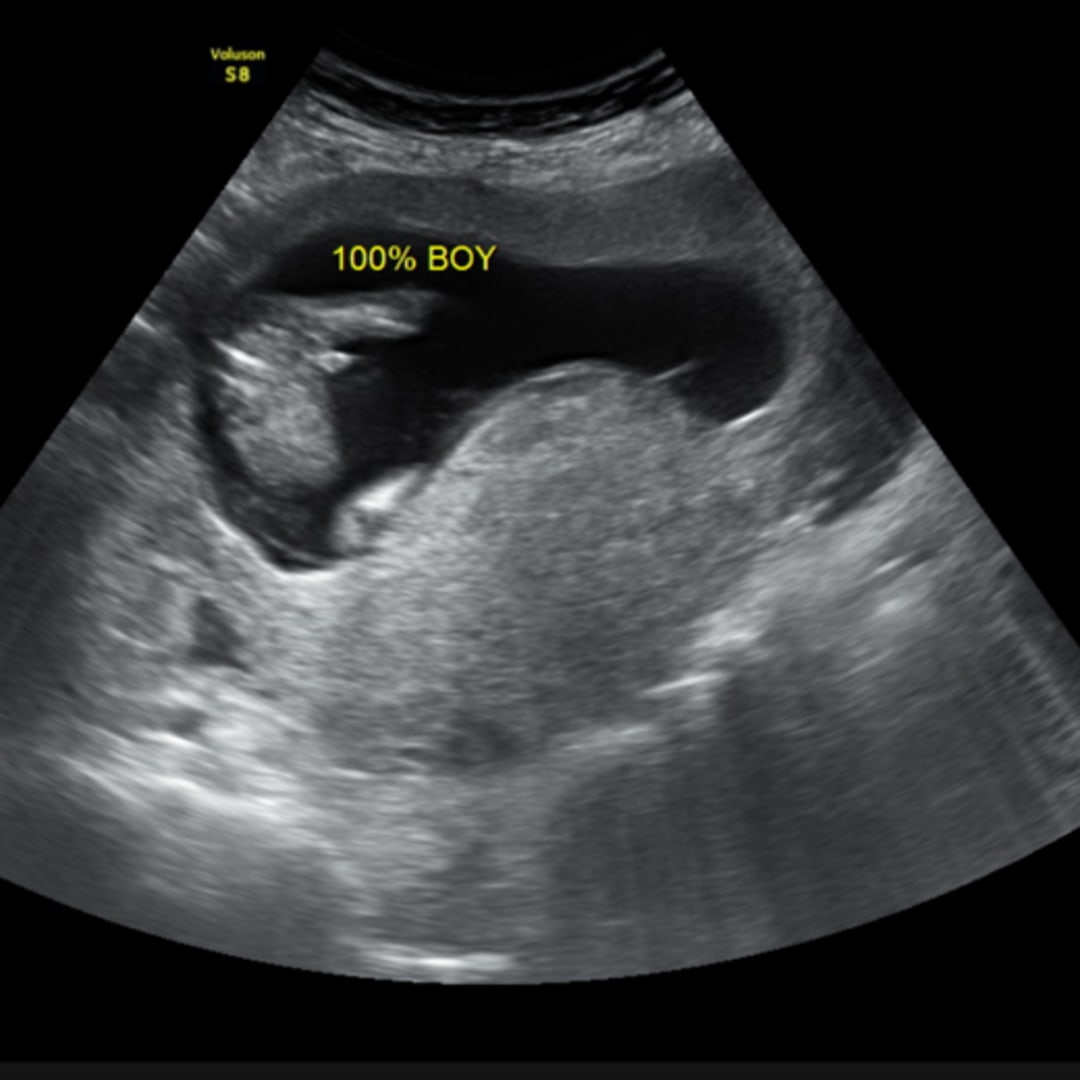 Photo shared by Gina for their Babylist baby registry.