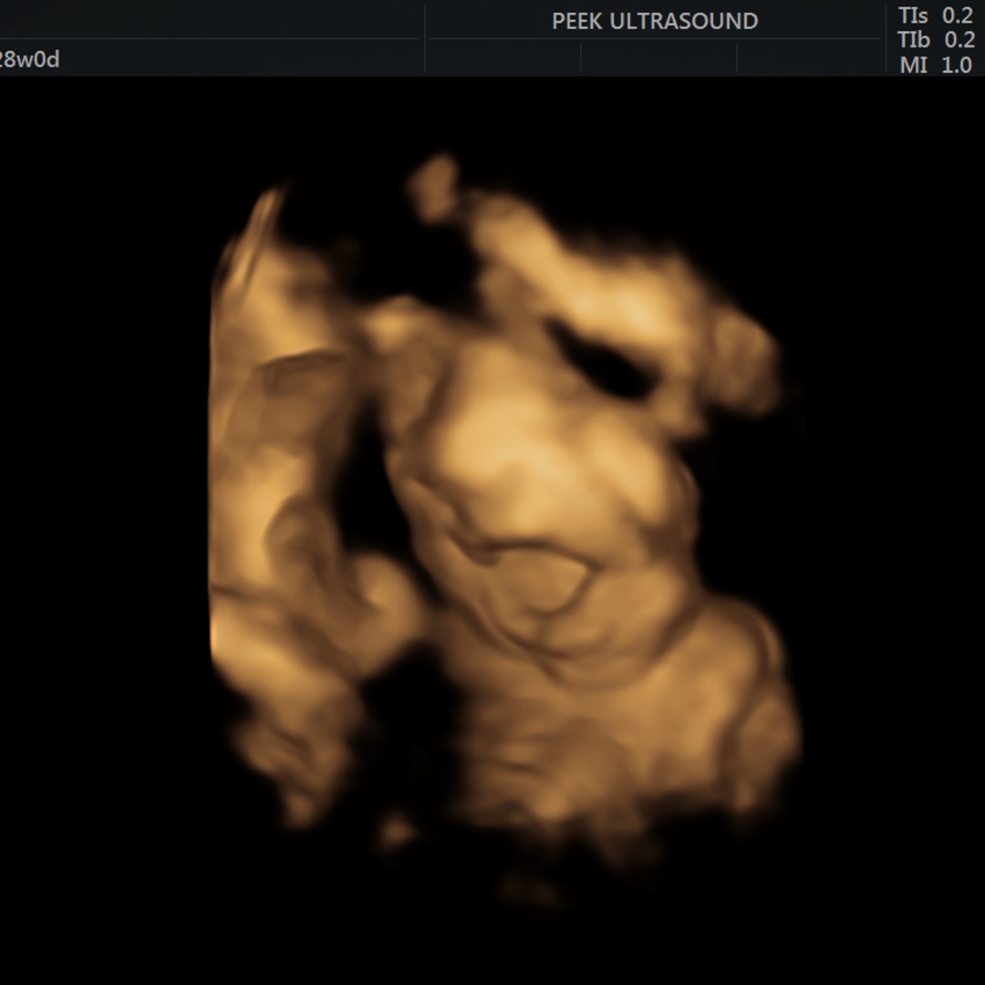 Photo shared by Yamileth for their Babylist baby registry.