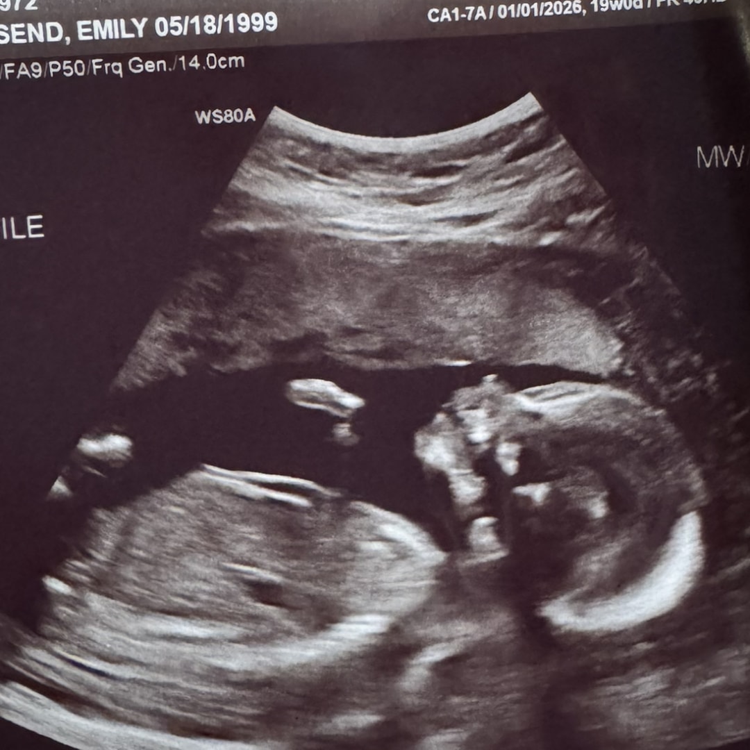 Photo shared by Emily for their Babylist baby registry.