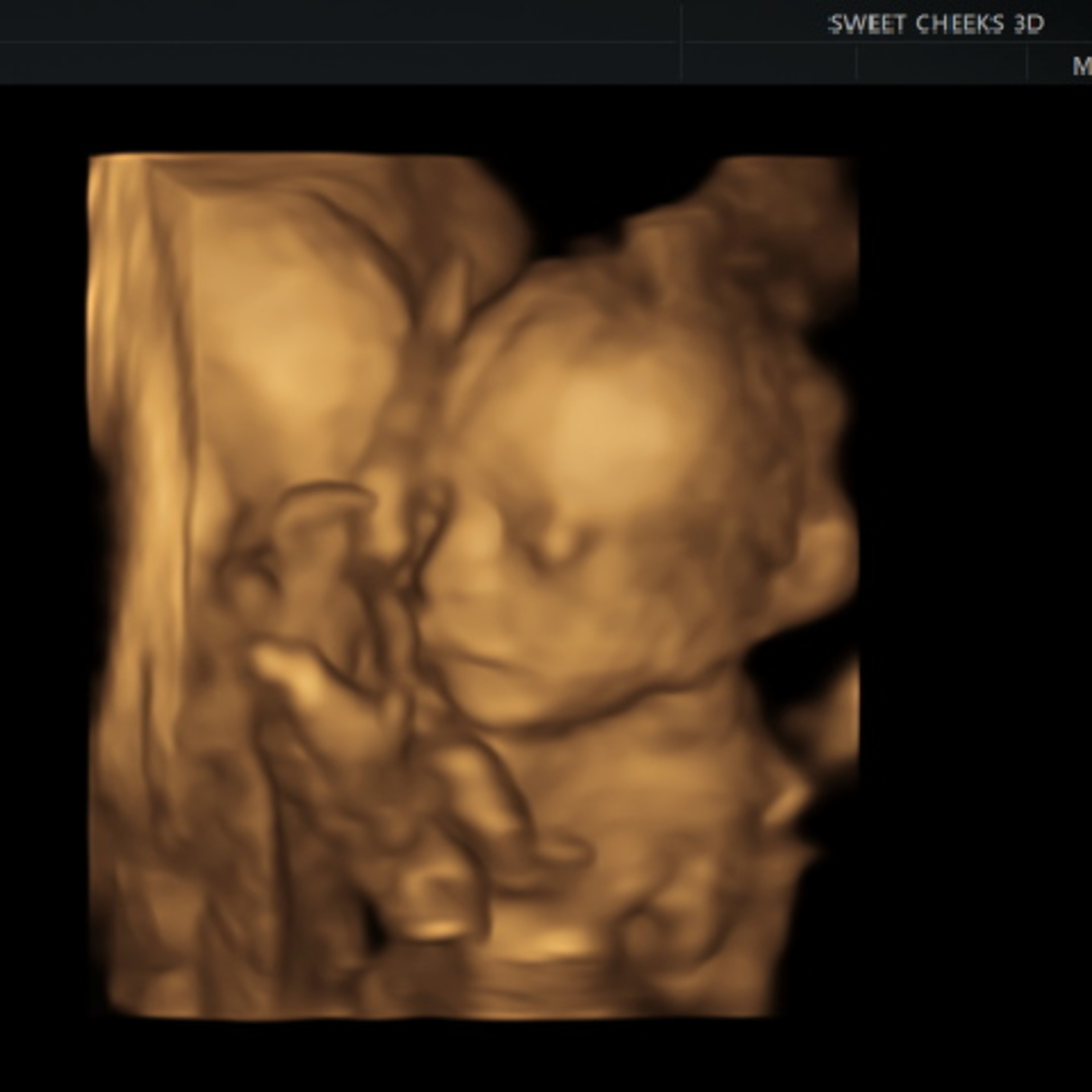 Photo shared by Madi for their Babylist baby registry.