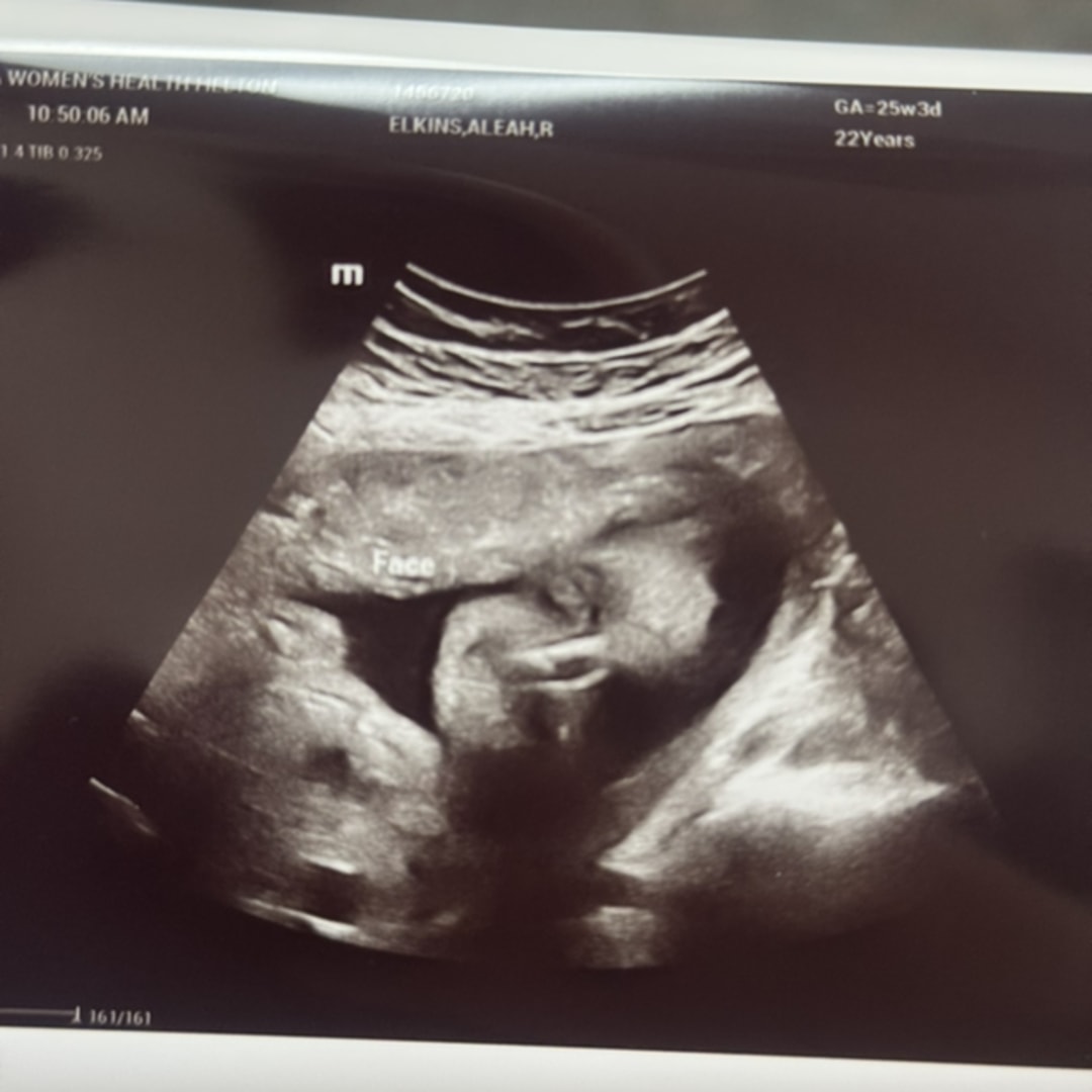 Photo shared by Aleah for their Babylist baby registry.