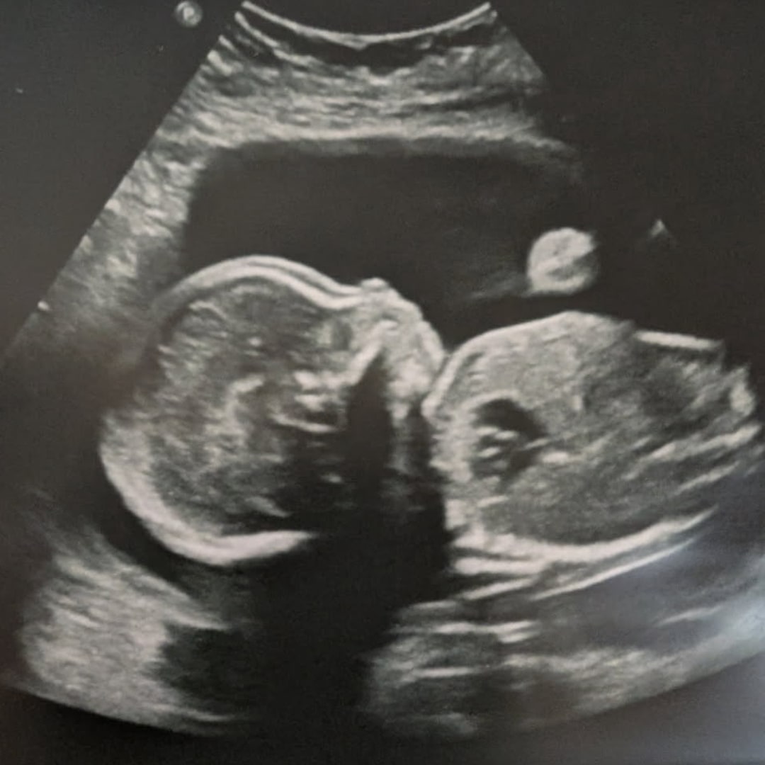 Photo shared by Josie for their Babylist baby registry.