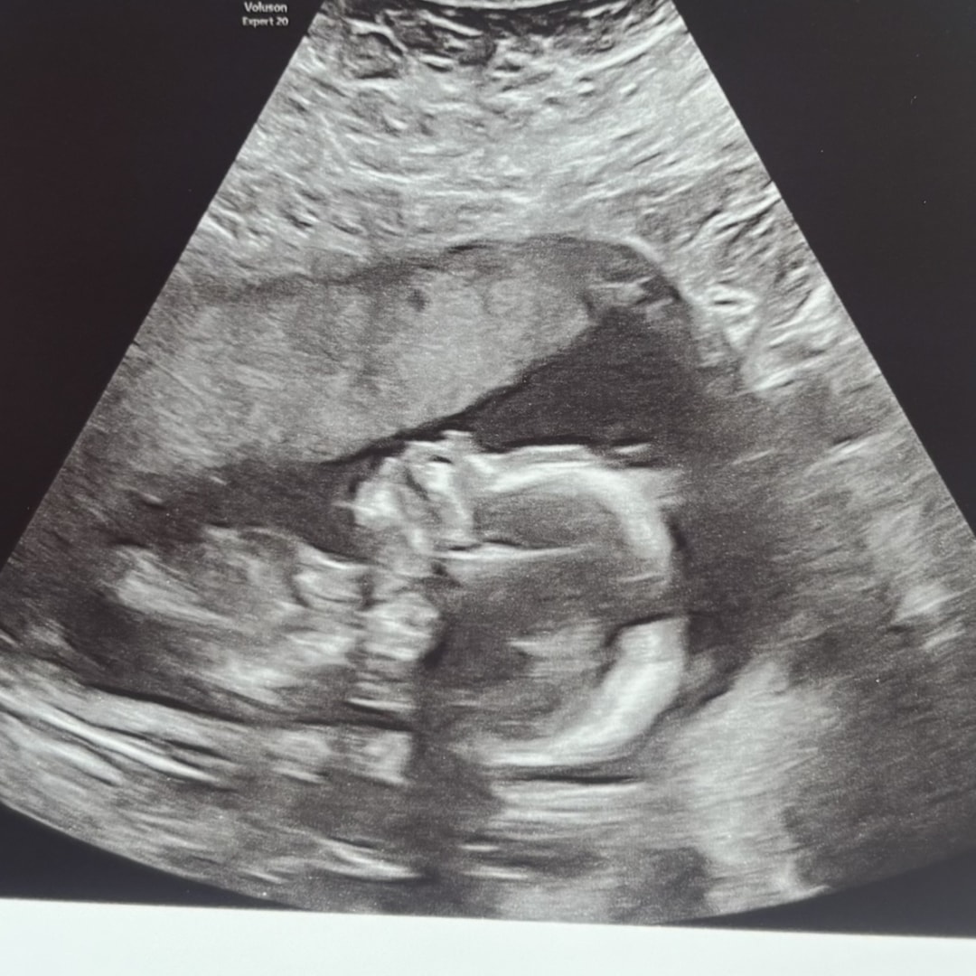Photo shared by Allie for their Babylist baby registry.