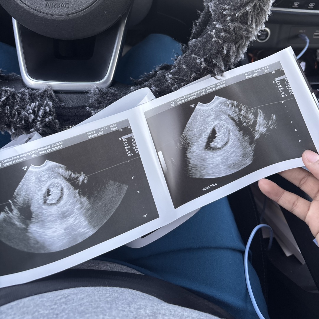 Photo shared by Alyssa for their Babylist baby registry.