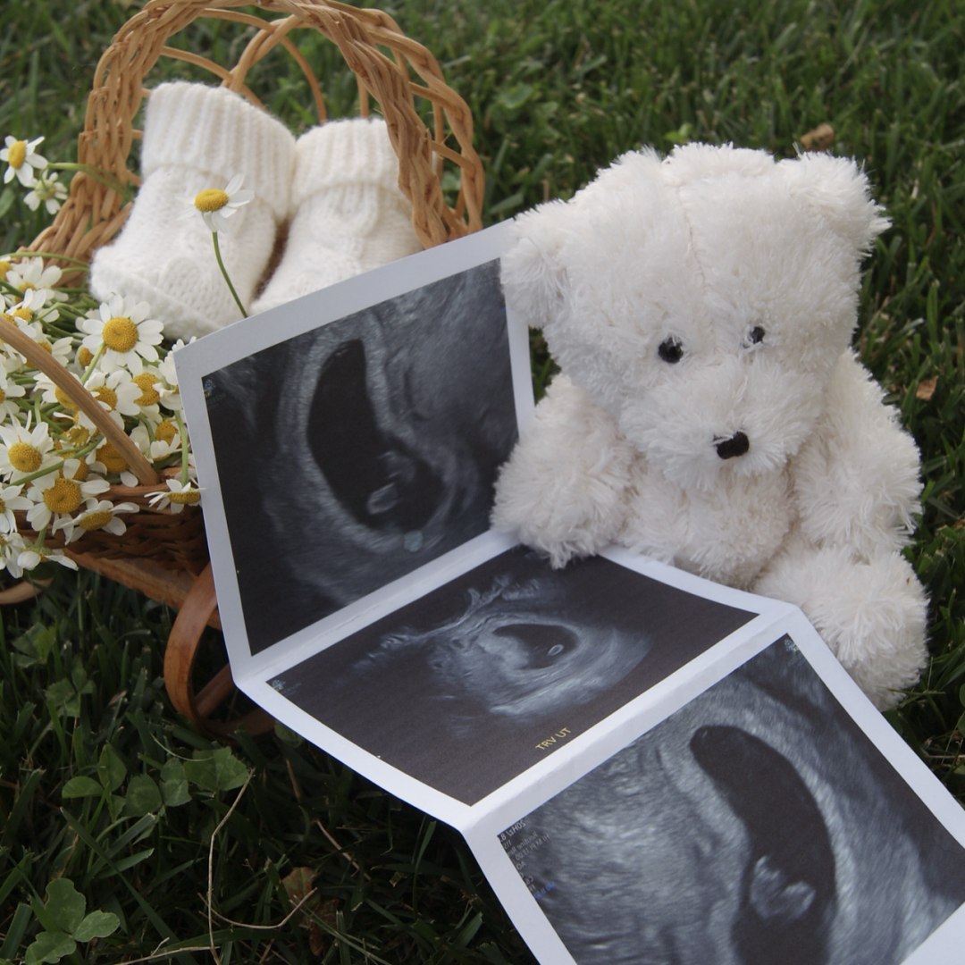 Photo shared by Lauren for their Babylist baby registry.