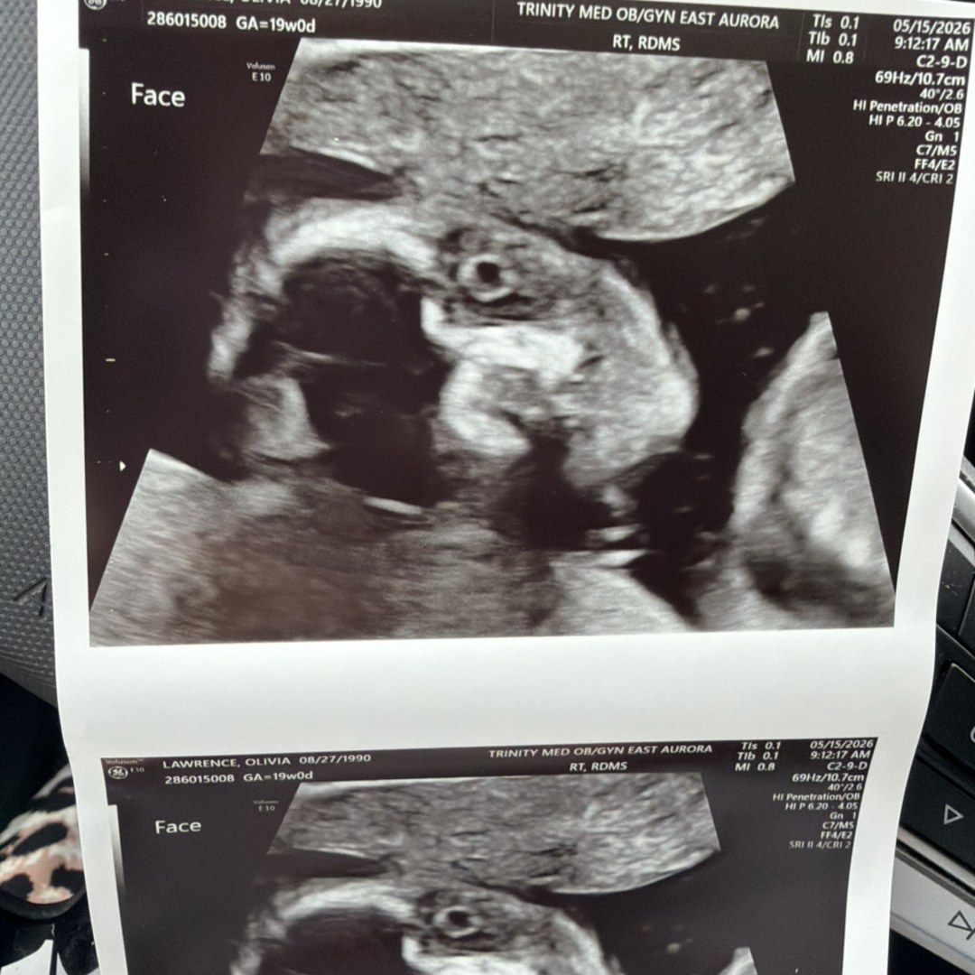 Photo shared by Olivia for their Babylist baby registry.