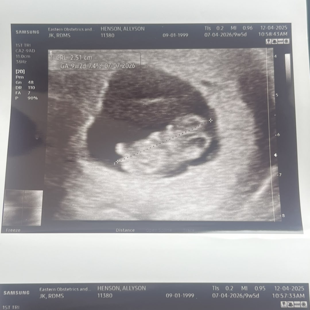 Photo shared by Allyson for their Babylist baby registry.