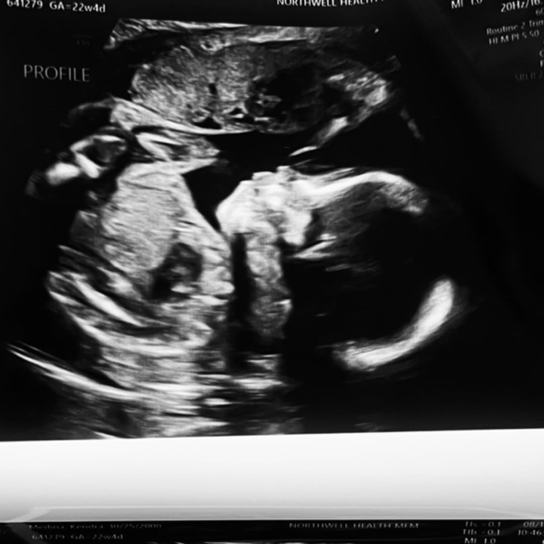 Photo shared by Kendra for their Babylist baby registry.