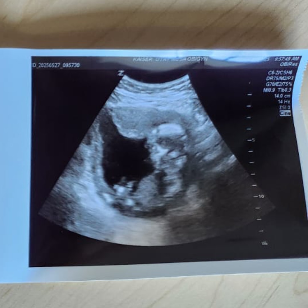 Photo shared by Lily for their Babylist baby registry.