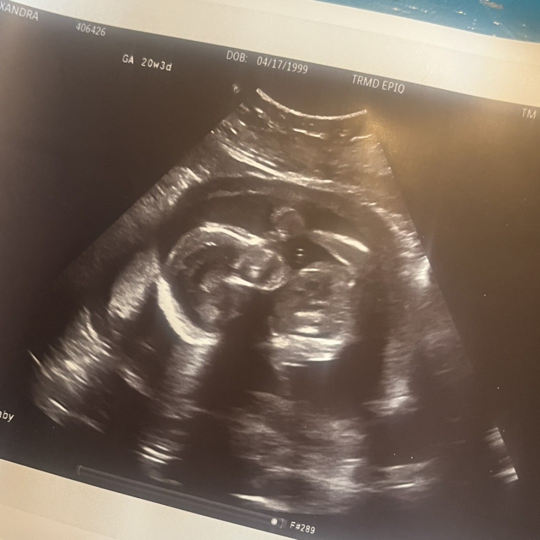 Photo shared by Ally for their Babylist baby registry.