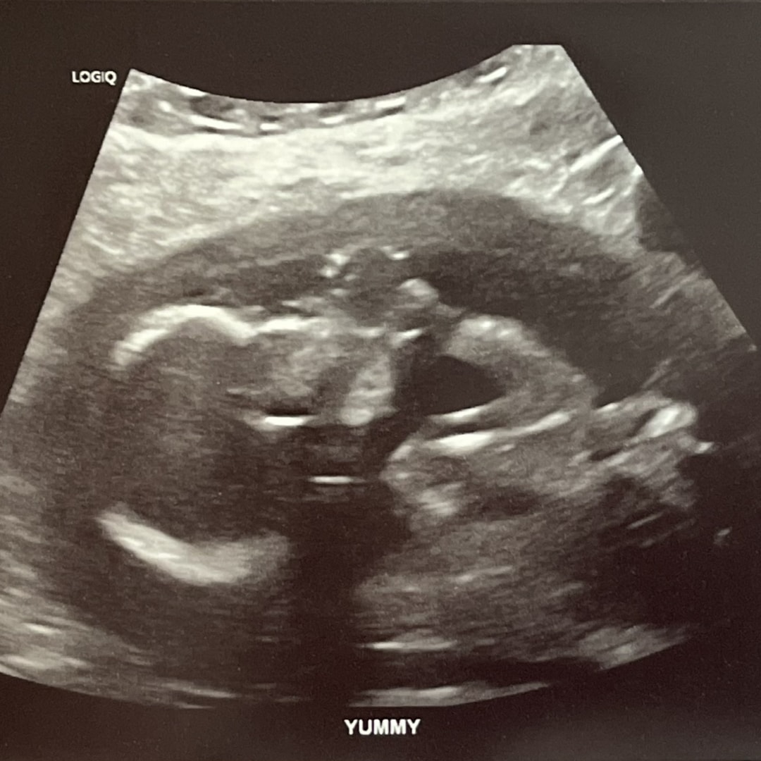 Photo shared by Ariyanna for their Babylist baby registry.