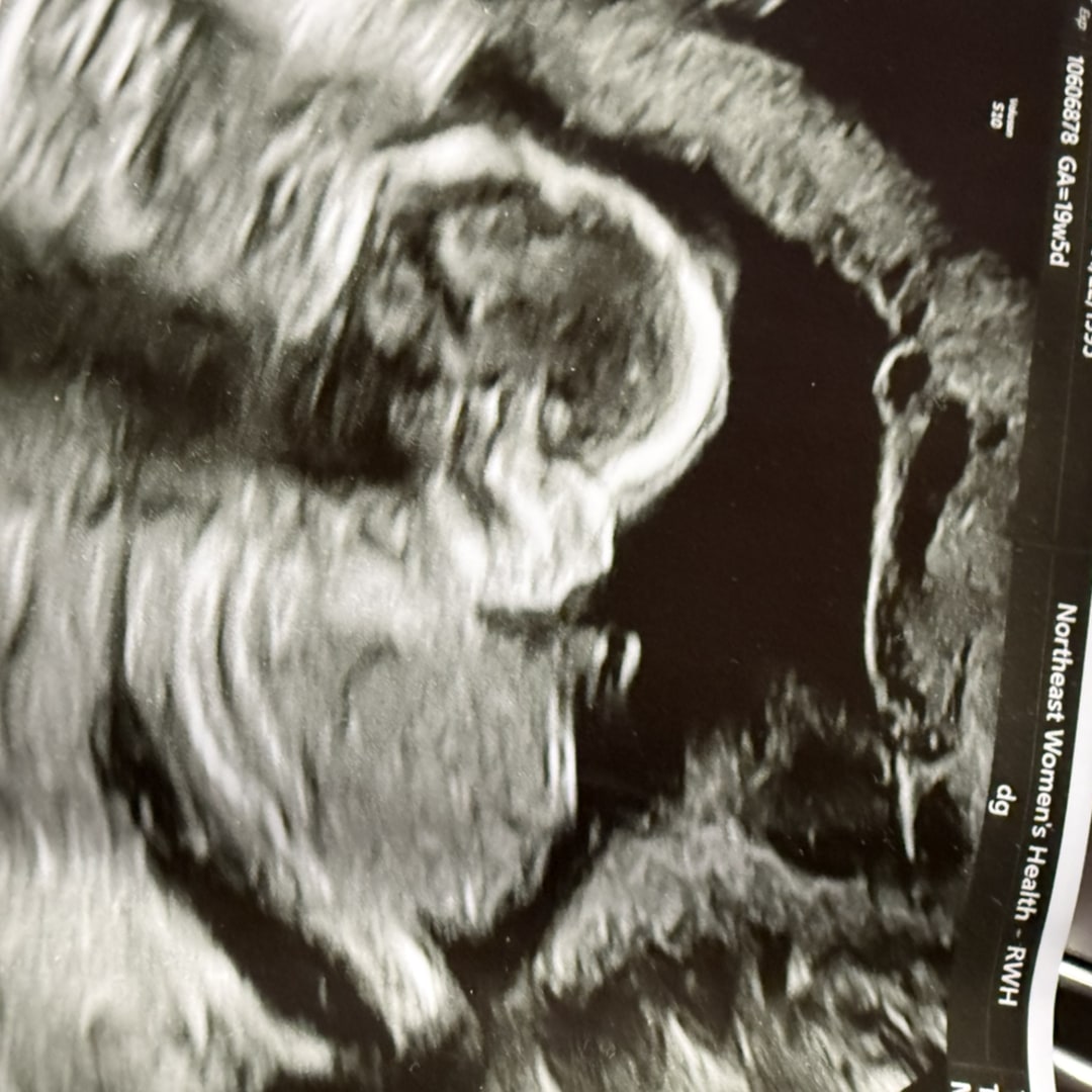 Photo shared by Marissa for their Babylist baby registry.