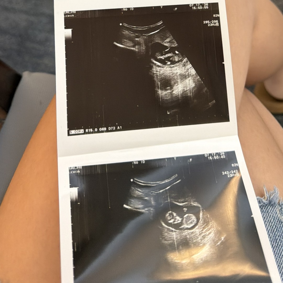 Photo shared by Haley for their Babylist baby registry.