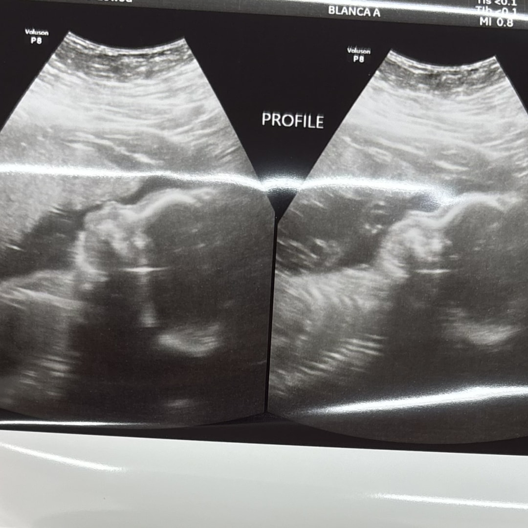 Photo shared by Cristal for their Babylist baby registry.