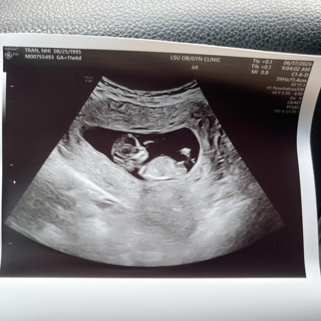Photo shared by Nina for their Babylist baby registry.