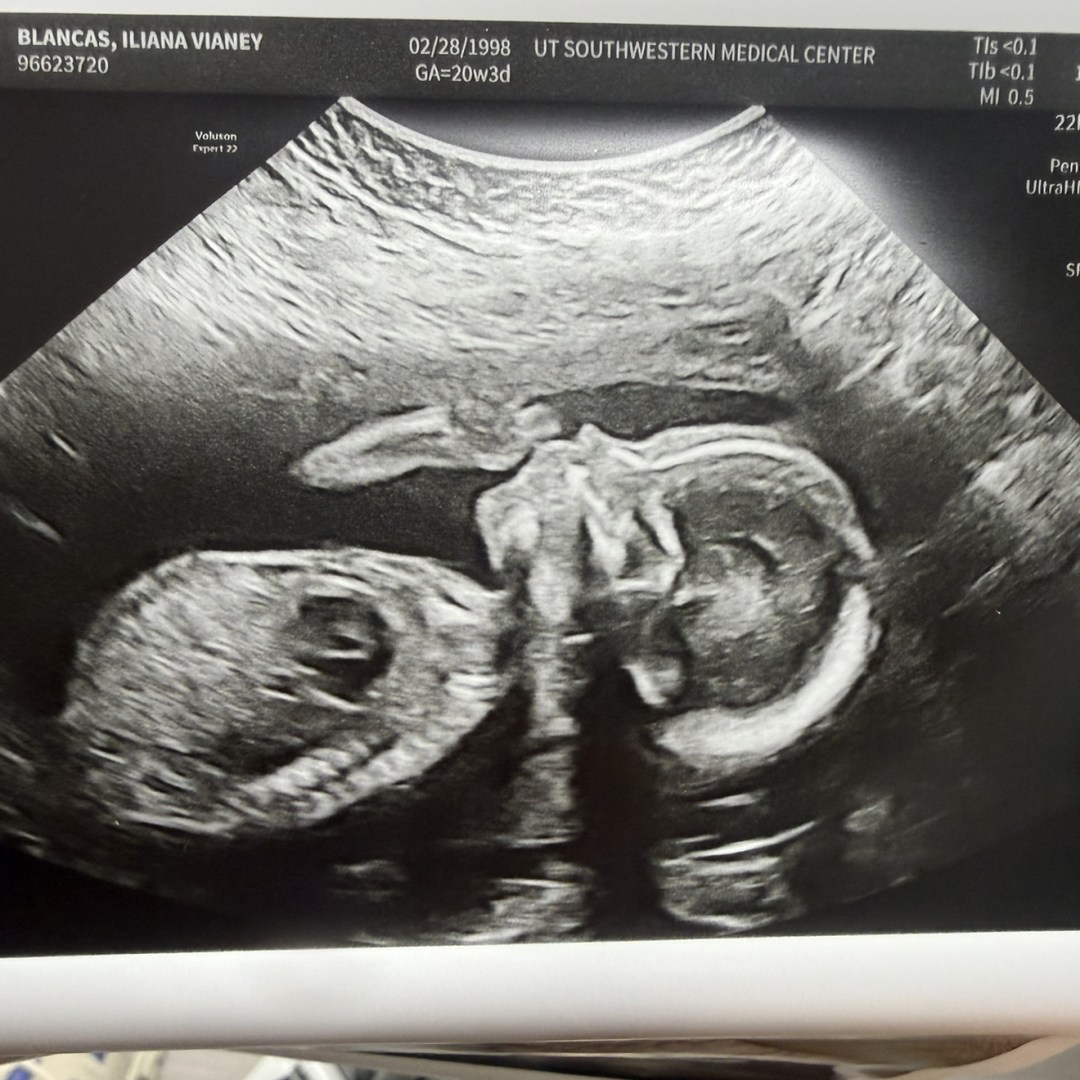 Photo shared by Iliana for their Babylist baby registry.