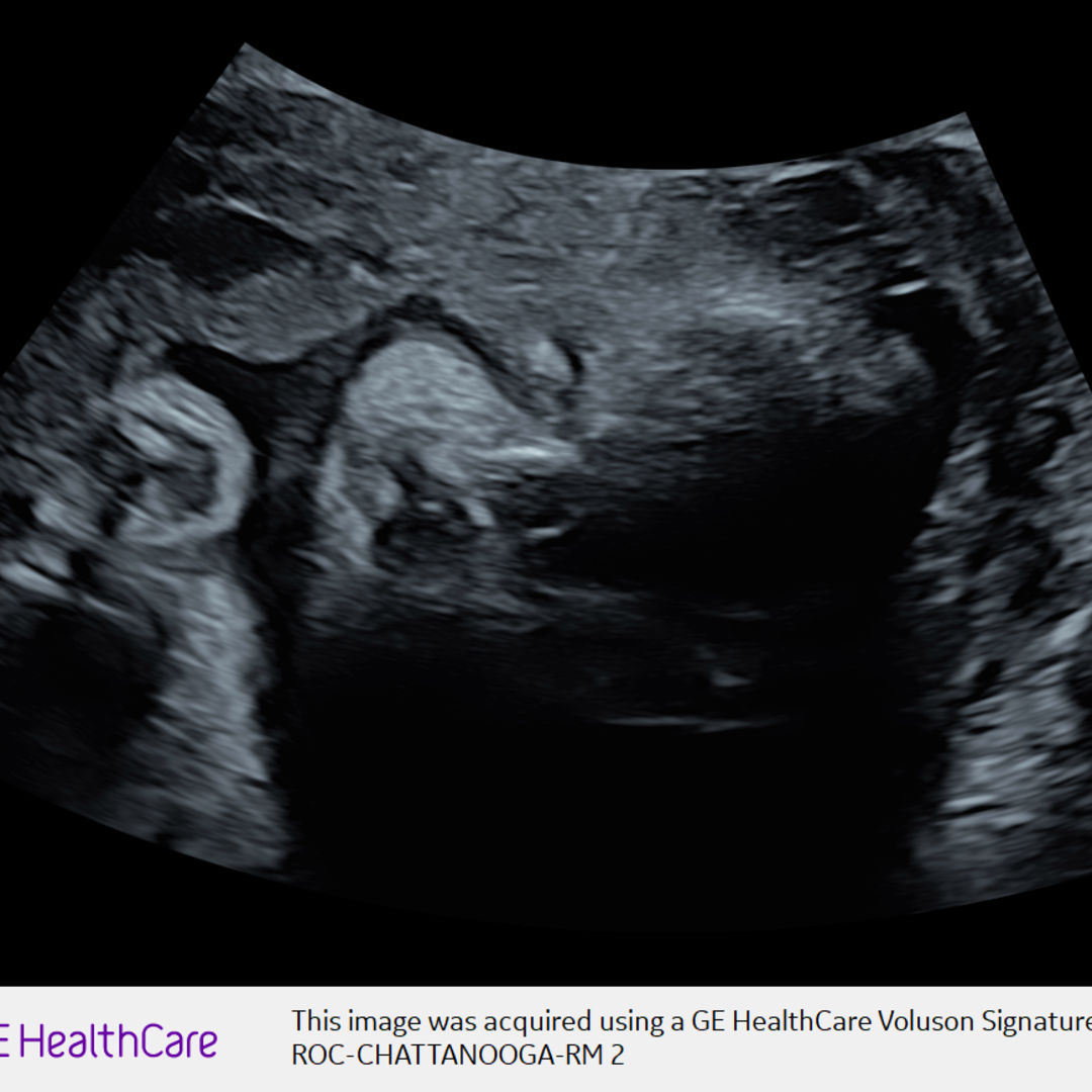 Photo shared by Alejandra for their Babylist baby registry.