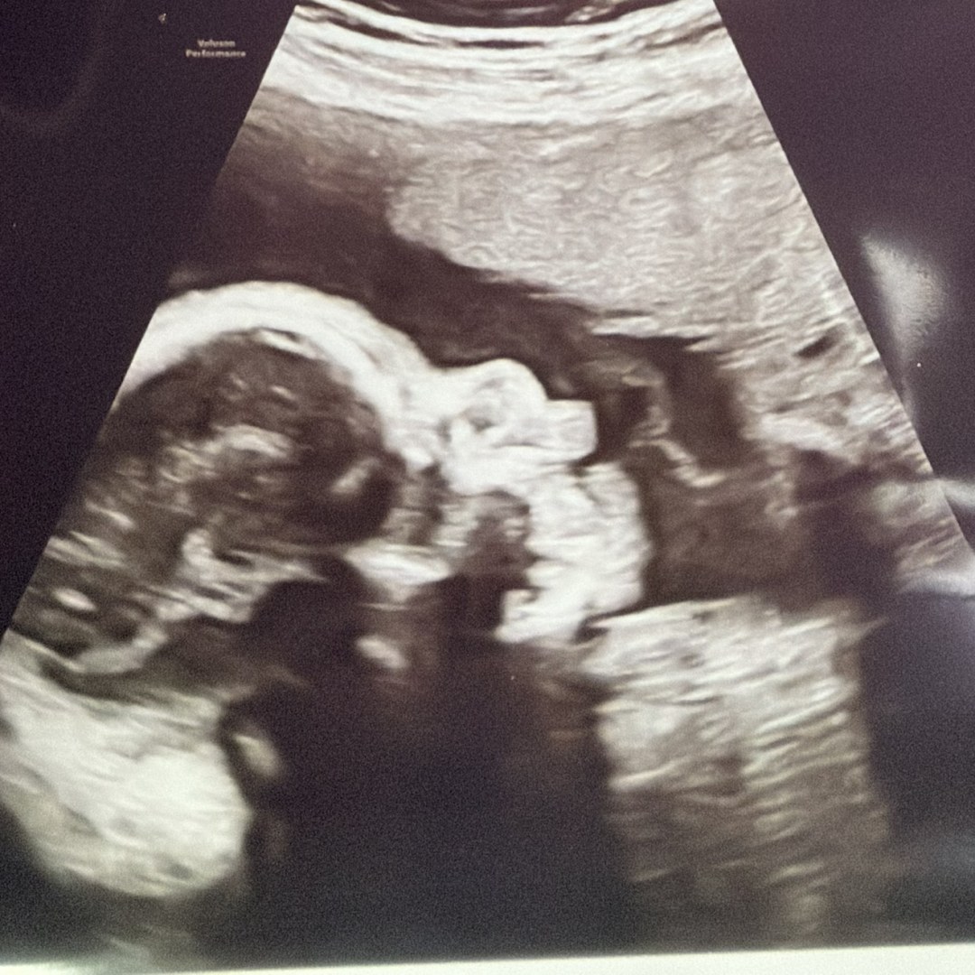 Photo shared by Olga for their Babylist baby registry.