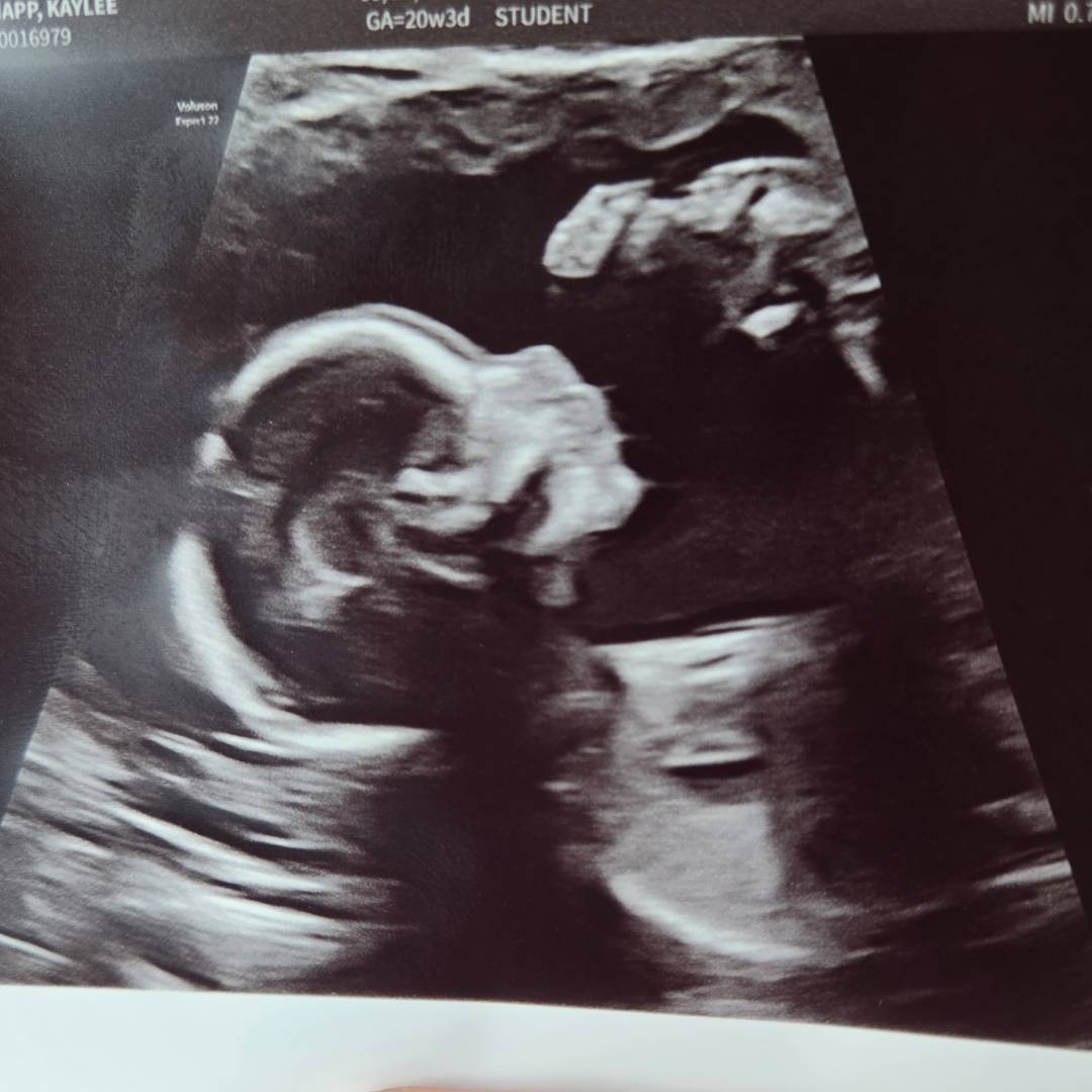 Photo shared by Kaylee for their Babylist baby registry.