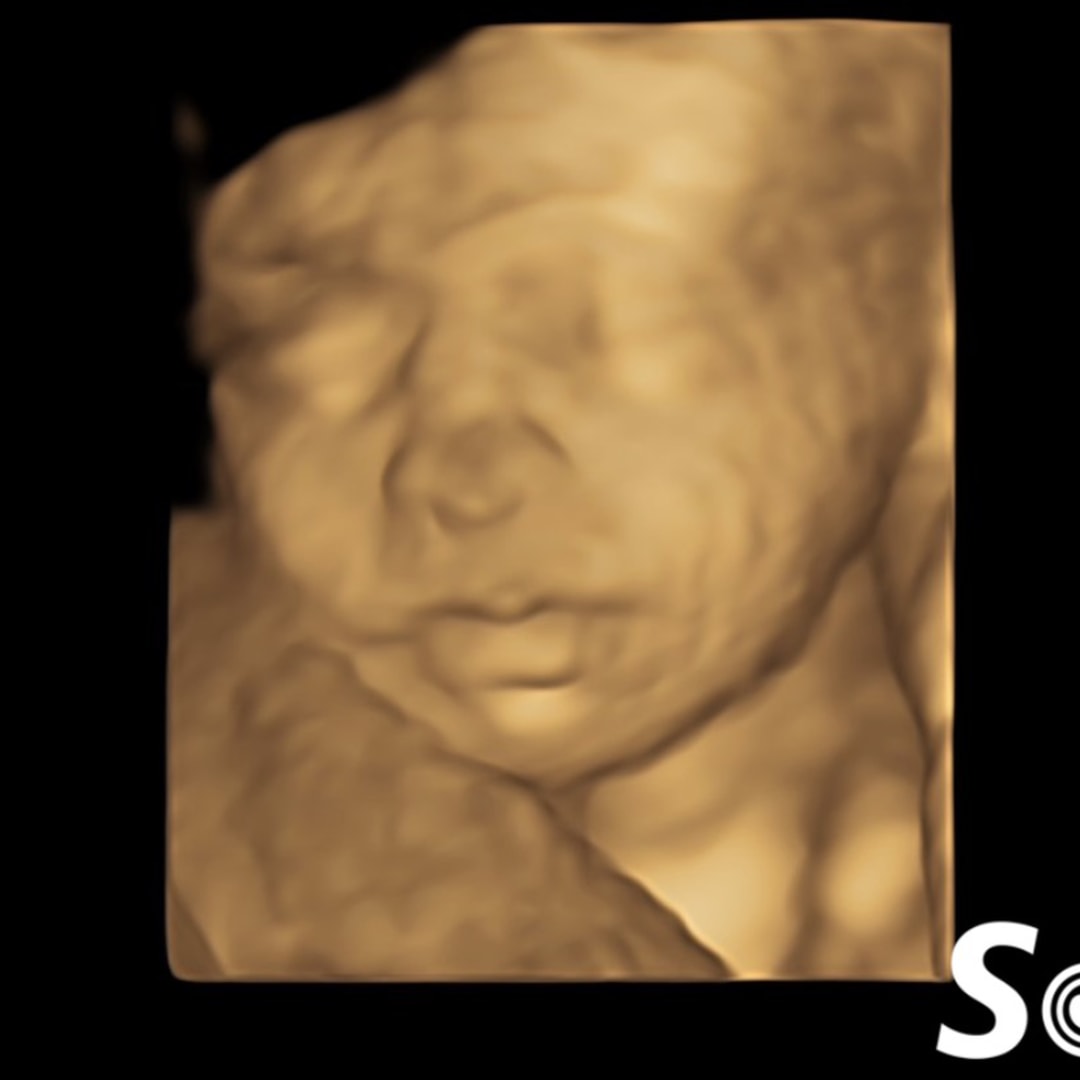 Photo shared by Allison for their Babylist baby registry.
