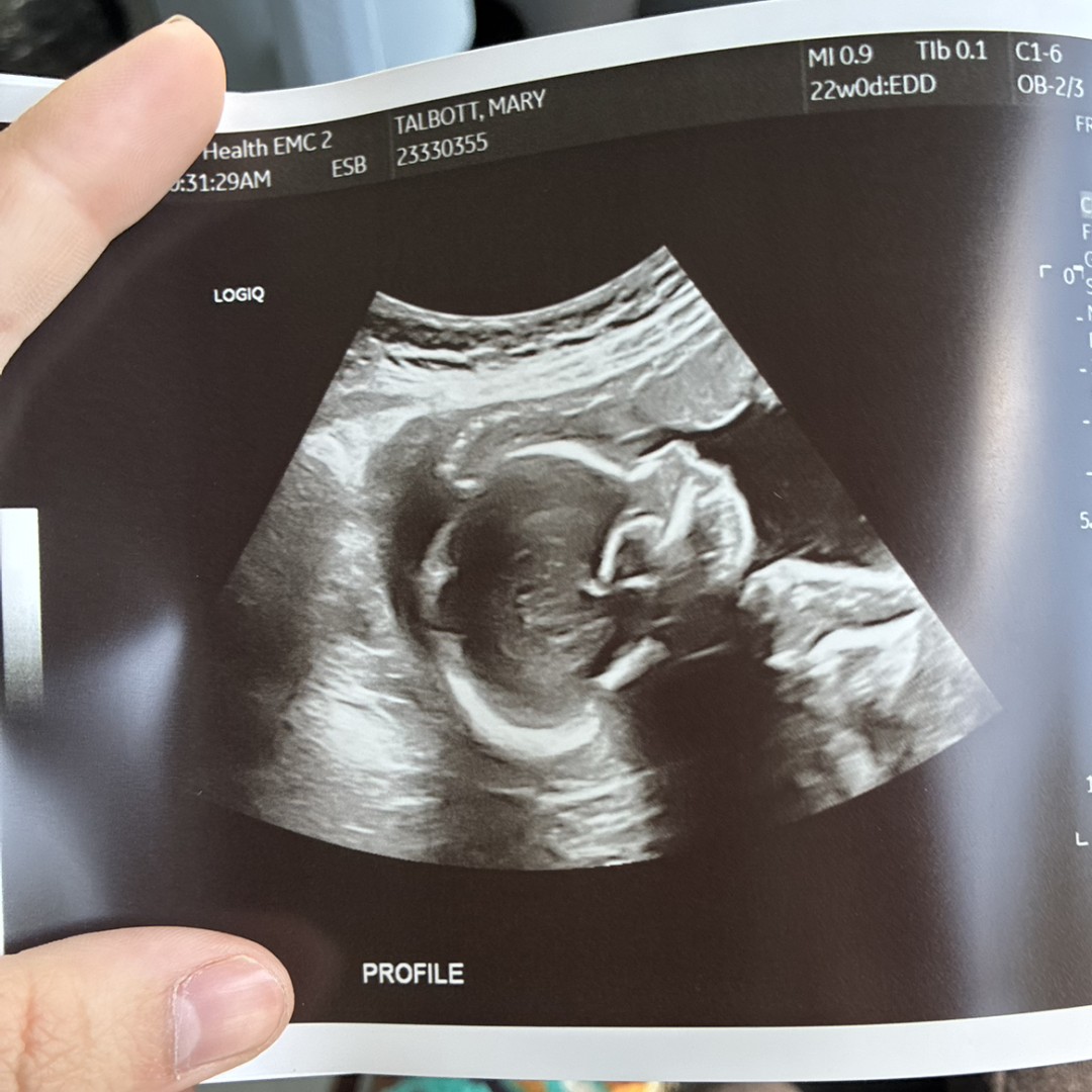 Photo shared by Mary for their Babylist baby registry.