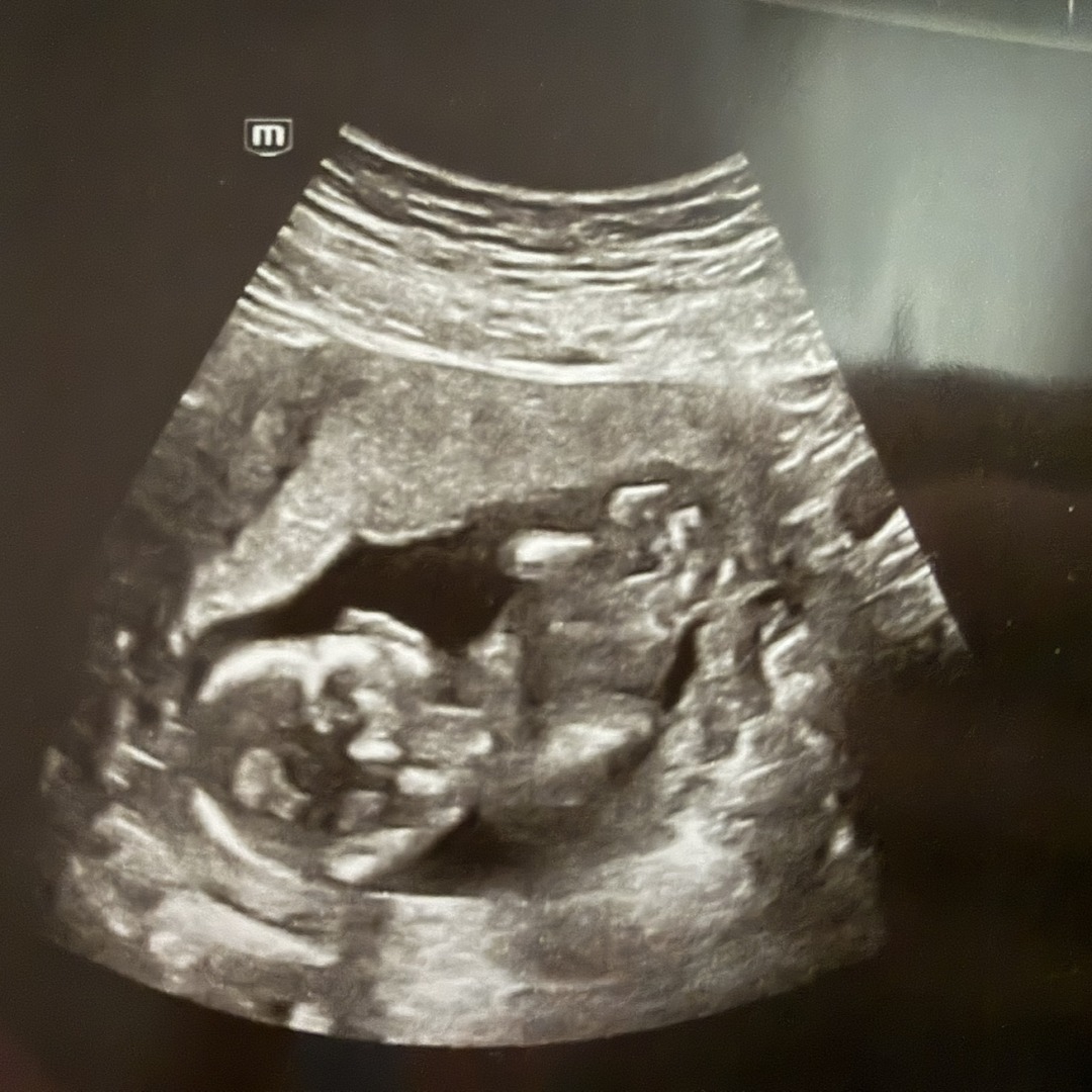 Photo shared by Tabitha for their Babylist baby registry.