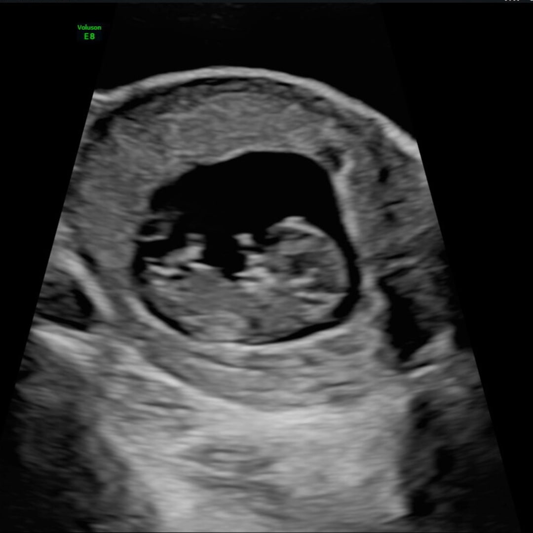 Photo shared by Alexandra for their Babylist baby registry.