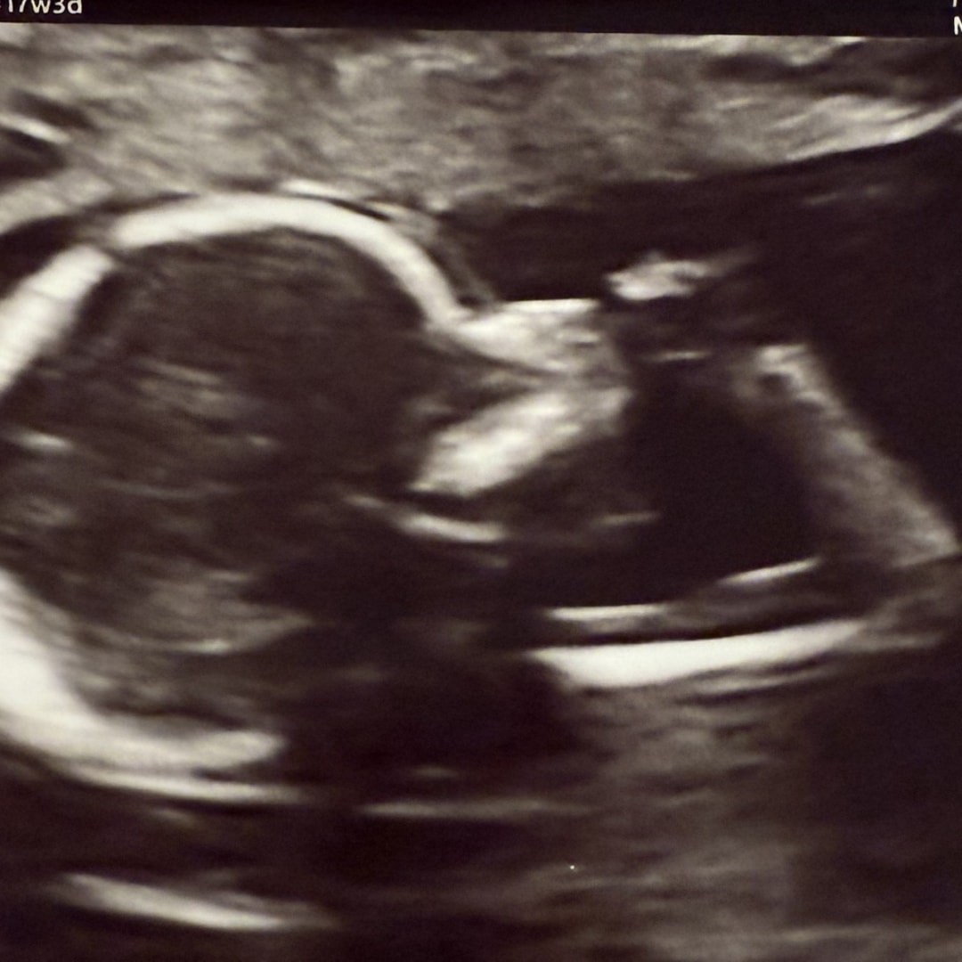 Photo shared by Cara for their Babylist baby registry.