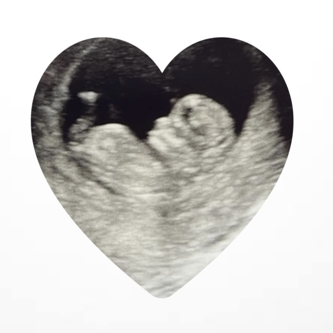 Photo shared by Melanie for their Babylist baby registry.